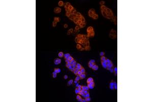 Immunofluorescence analysis of MCF7 cells using Thymidine Kinase 1 Rabbit pAb (ABIN6132726, ABIN6149198, ABIN6149199 and ABIN6221245) at dilution of 1:150 (40x lens).