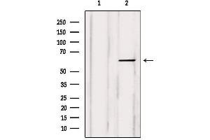Western blot analysis of extracts from Myeloma cells, using COT Antibody. (MAP3K8 Antikörper  (Internal Region))