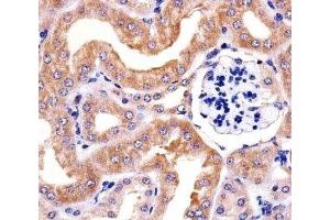 Immunohistochemistry (IHC) image for anti-Ribosomal Protein S6 (RPS6) antibody (ABIN3028983)