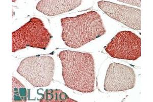 ABIN185312 (5µg/ml) staining of paraffin embedded Human Skeletal Muscle. (TOM1L2 Antikörper  (C-Term))