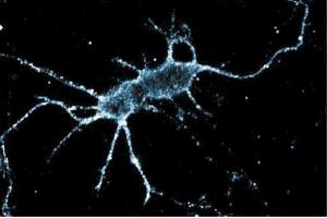 Immunofluorescence staining of rat neurons. (PKC iota Antikörper  (AA 404-587))