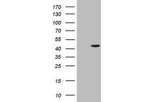 Western Blotting (WB) image for anti-alpha-Methylacyl-CoA Racemase (AMACR) antibody (ABIN2716025) (AMACR Antikörper)