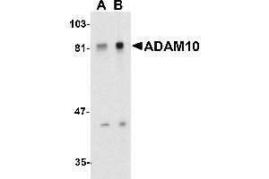 Western Blotting (WB) image for anti-ADAM Metallopeptidase Domain 10 (ADAM10) (C-Term) antibody (ABIN1030219) (ADAM10 Antikörper  (C-Term))