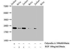 Western Blot Detected samples: Jurkat whole cell lysate, Hela whole cell lysate, Untreated (-) or treated (+) with Calyculin A and EGF All lanes: HIST1H1E antibody at 1:1000 Secondary Goat polyclonal to rabbit IgG at 1/40000 dilution Predicted band size: 22 kDa Observed band size: 22 kDa (HIST1H1E Antikörper  (pThr17))