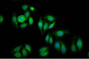 Immunofluorescence staining of A549 cells with ABIN7152126 at 1:100, counter-stained with DAPI. (EIF1 Antikörper  (AA 2-113))