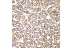Immunohistochemistry of paraffin-embedded rat liver using UGDH antibody at dilution of 1:100 (400x lens). (UGDH Antikörper)
