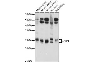 Western blot analysis of extracts of various cell lines, using PLP1 antibody (ABIN7269724) at 1:1000 dilution. (PLP1 Antikörper  (AA 145-210))