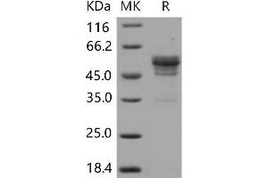 Western Blotting (WB) image for CD99 (CD99) protein (Fc Tag) (ABIN7320251) (CD99 Protein (CD99) (Fc Tag))