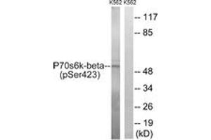 Western blot analysis of extracts from K562 cells treated with EGF 200ng/ml 5', using p70 S6 Kinase beta (Phospho-Ser423) Antibody.
