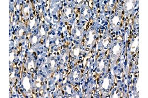 ABIN6264016 and ABIN6268722 at 1/100 staining Rat kidney tissue by IHC-P. (SERPINB2 Antikörper  (Internal Region))