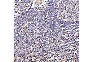 IHC analysis of NDUFAF1 using anti-NDUFAF1 antibody (ABIN7602459).
