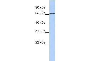 WB Suggested Anti-SLC27A6 Antibody Titration:  0. (SLC27A6 Antikörper  (Middle Region))