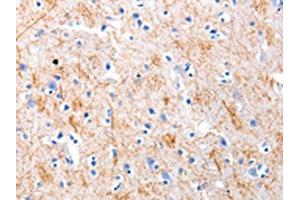 The image on the left is immunohistochemistry of paraffin-embedded Human brain tissue using ABIN7191217(KISS1 Antibody) at dilution 1/5, on the right is treated with synthetic peptide.