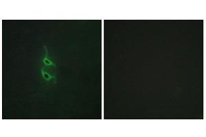 Immunofluorescence (IF) image for anti-Mannose Receptor, C Type 2 (MRC2) (N-Term) antibody (ABIN1850036) (MRC2 Antikörper  (N-Term))