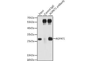 Immunoprecipitation analysis of 200 μg extracts of 293T cells, using 3 μg  antibody (ABIN6132132, ABIN6136638, ABIN6136639 and ABIN6222173). (AGPAT1 Antikörper  (AA 204-283))