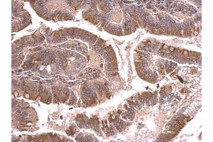 IHC-P Image beta Tubulin 2 antibody detects beta Tubulin 2 protein at cytosol on mouse duodenum by immunohistochemical analysis. (TUBB2A Antikörper)