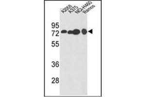 Western Blotting (WB) image for anti-Hydroxyacyl-Coenzyme A Dehydrogenase/3-Ketoacyl-Coenzyme A Thiolase/enoyl-Coenzyme A Hydratase (Trifunctional Protein), alpha Subunit (HADHA) (AA 734-763), (C-Term) antibody (ABIN453085)