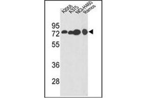 Western blot analysis of HADHA Antibody (C-term) in A2058, A375, NCI-H460, Ramos cell line lysates (35ug/lane). (HADHA Antikörper  (C-Term))