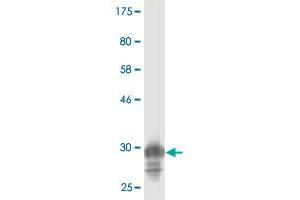 Western Blot detection against Immunogen (33. (ATP6V0D1 Antikörper  (AA 238-308))