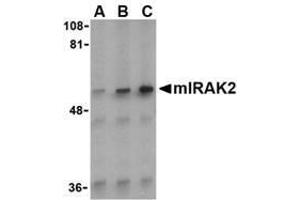 Western blot analysis of IRAK2 in A-20 whole cell lysate with AP30440PU-N IRAK2 antibody (C2) at (A) 0. (IRAK2 Antikörper  (C-Term))