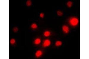 Immunofluorescent analysis of TFE3 staining in PC12 cells.