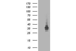 HEK293T cells were transfected with the pCMV6-ENTRY control (Left lane) or pCMV6-ENTRY ATG3 (Right lane) cDNA for 48 hrs and lysed. (ATG3 Antikörper)