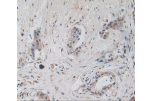 Detection of AREG in Human Pancreas Cancer Tissue using Monoclonal Antibody to Amphiregulin (AREG)