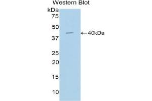 Detection of Recombinant CTSD, Mouse using Polyclonal Antibody to Cathepsin D (CTSD) (Cathepsin D Antikörper  (AA 66-410))