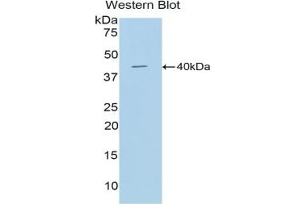 Cathepsin D anticorps  (AA 66-410)