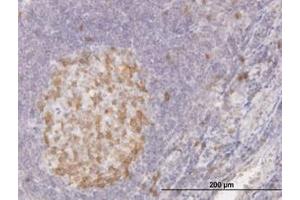Image no. 1 for anti-Cyclin-Dependent Kinase 1 (CDK1) (AA 211-298) antibody (ABIN598557) (CDK1 Antikörper  (AA 211-298))