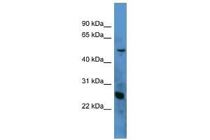 Western Blot showing C1QA antibody used at a concentration of 1-2 ug/ml to detect its target protein. (C1QA Antikörper  (N-Term))