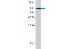 Western Blot detection against Immunogen (78. (AKT1 Antikörper  (AA 1-480))