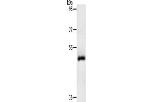 Gel: 10 % SDS-PAGE, Lysate: 40 μg, Lane: Human liver cancer tissue, Primary antibody: ABIN7131158(SPATA17 Antibody) at dilution 1/200, Secondary antibody: Goat anti rabbit IgG at 1/8000 dilution, Exposure time: 10 minutes (SPATA17 Antikörper)
