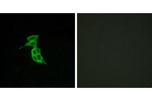 Peptide - +Immunofluorescence analysis of LOVO cells, using GPR143 antibody. (GPR143 Antikörper  (Internal Region))