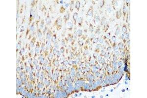 Immunohistochemistry of paraffin-embedded Human esophagus using MTCO2 Polyclonal Antibody at dilution of 1:100 (40x lens). (COX2 Antikörper)