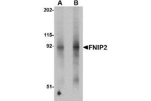 Western blot analysis of FNIP2 in mouse skeletal muscle lysate with AP30346PU-N FNIP2 antibody at (A) 1 and (B) 2 μg/ml. (FNIP2 Antikörper  (N-Term))