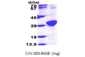 SDS-PAGE (SDS) image for RAB6A, Member RAS Oncogene Family (RAB6A) (AA 1-208) protein (His tag) (ABIN667298) (RAB6A Protein (AA 1-208) (His tag))