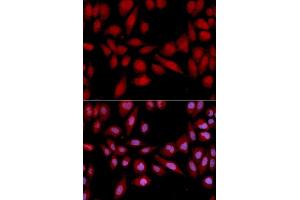 Immunofluorescence (IF) image for anti-Proteasome Subunit alpha 2 (PSMA2) (AA 1-234) antibody (ABIN3016153)