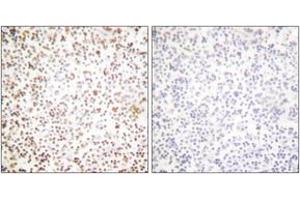 Immunohistochemistry analysis of paraffin-embedded human lymph node tissue, using OCT1 Antibody. (POU2F1 Antikörper  (AA 41-90))