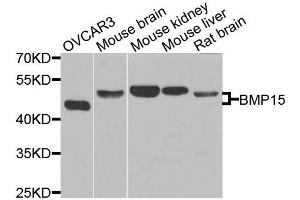Western blot analysis of extracts of various cells, using BMP15 antibody. (BMP15 Antikörper)