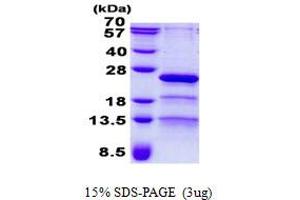Retinitis Pigmentosa 9 (Autosomal Dominant) (RP9) protein (His tag)