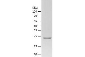 Western Blotting (WB) image for ZW10 Interactor (ZWINT) (AA 1-230) protein (His tag) (ABIN7125819) (ZWINT Protein (AA 1-230) (His tag))