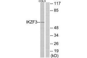 Western Blotting (WB) image for anti-IKAROS Family Zinc Finger 3 (Aiolos) (IKZF3) (Internal Region) antibody (ABIN1850075) (IKZF3 Antikörper  (Internal Region))