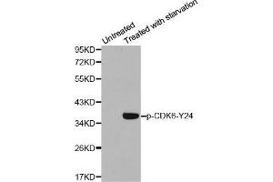 Western blot analysis of extracts from 293 cells using Phospho-CDK6-Y24 antibody. (CDK6 Antikörper  (pTyr24))