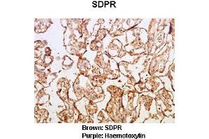 Sample Type :  Human placental tissue   Primary Antibody Dilution :   1:50  Secondary Antibody :  Goat anti rabbit-HRP   Secondary Antibody Dilution :   1:10,000  Color/Signal Descriptions :  Brown: SDPR Purple: Haemotoxylin  Gene Name :  Sdpr  Submitted by :  Dr. (SDPR Antikörper  (N-Term))