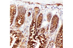 Anti-Hsc70 antibody, IHC(F) IHC(F): Rat Intestine Tissue (Hsc70 Antikörper  (N-Term))