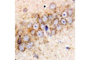 Immunohistochemical analysis of HSPA6 staining in rat brain formalin fixed paraffin embedded tissue section. (HSPA6 Antikörper)
