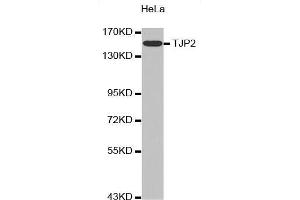 Western Blotting (WB) image for anti-Tight Junction Protein 2 (Zona Occludens 2) (TJP2) (AA 951-1190) antibody (ABIN6213898) (TJP2 Antikörper  (AA 951-1190))