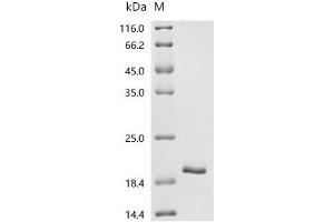 (Tris-Glycine gel) Discontinuous SDS-PAGE (reduced) with 5 % enrichment gel and 15 % separation gel.