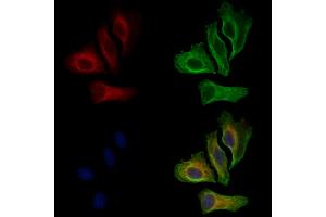 ABIN6261462 and ABIN6269075 staining Hela cells by IF/ICC.